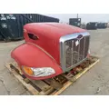 PETERBILT 335 Hood thumbnail 3