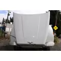 PETERBILT 567 Hood thumbnail 4